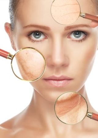 photoaging